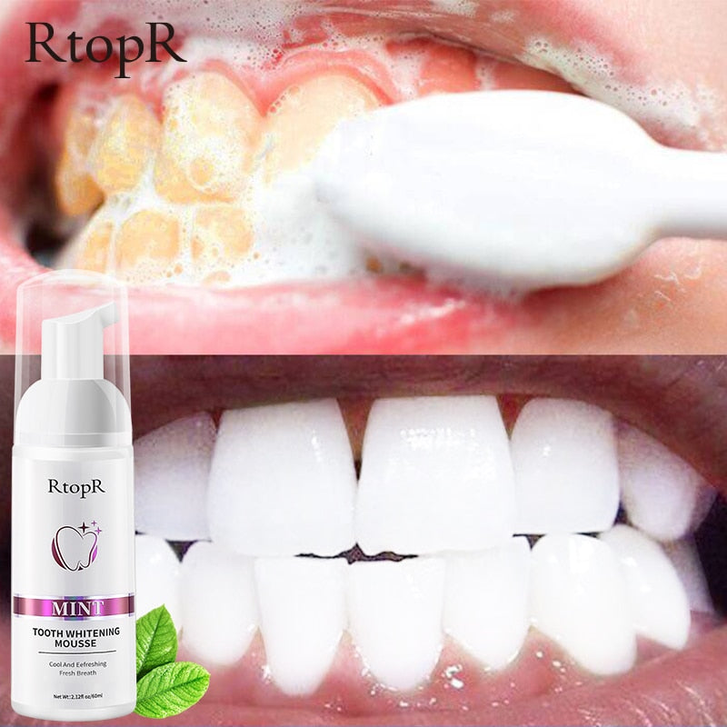 Tooth Whitening Mousse - Next Gen Retail Store