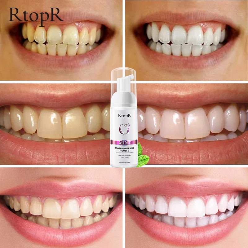 Tooth Whitening Mousse - Next Gen Retail Store