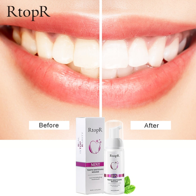 Tooth Whitening Mousse - Next Gen Retail Store